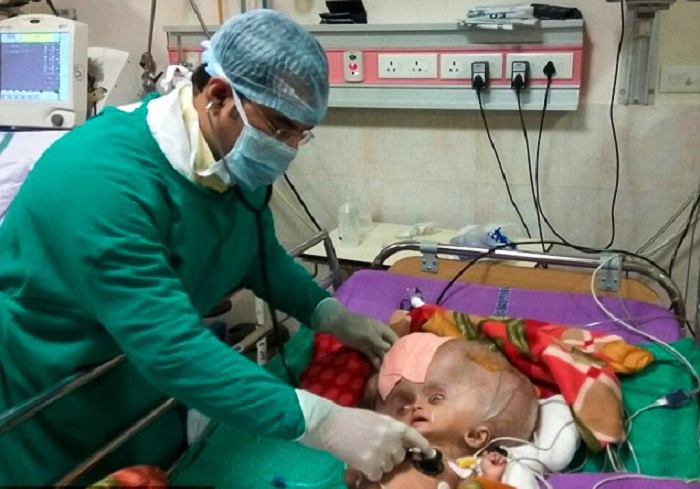 Boy with `the world`s largest head` has surgery